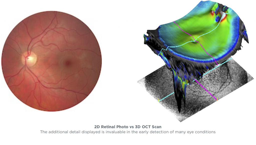 benefits-of-an-enhanced-eye-examination-spectacle-maker-ni